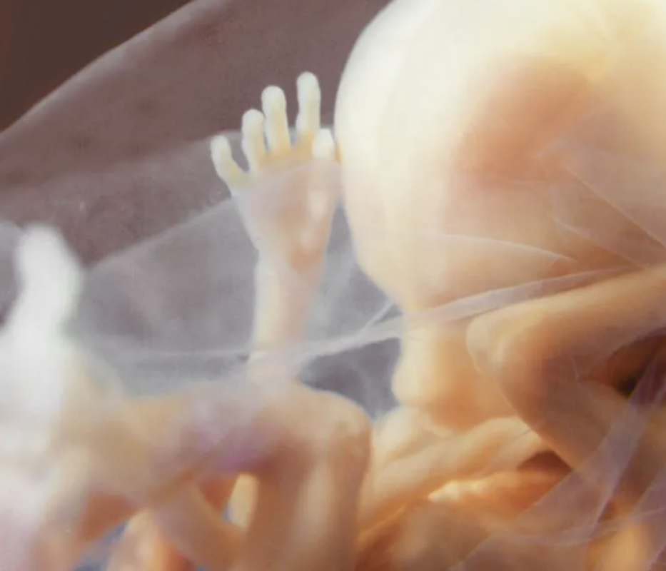 Abortion
